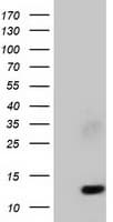 FSHB / FSH Beta Antibody (clone OTI4E8)