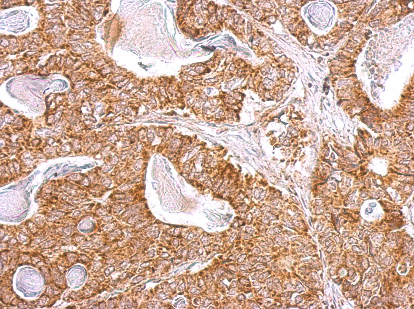 NDUFB9 Antibody (aa1-162)