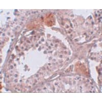 CABS1 Antibody