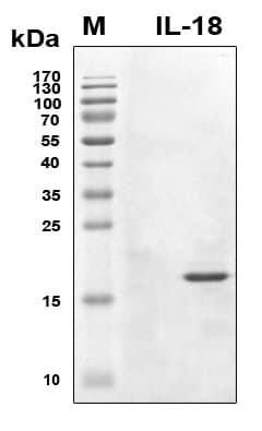 Human IL18 Protein (Recombinant 6His, N-terminus)