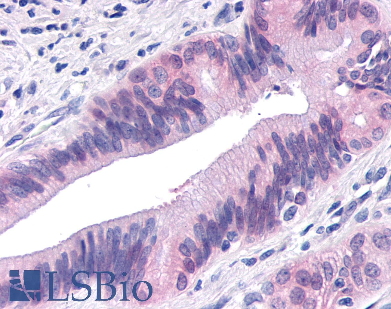 IHC-plus™ TNIK Antibody (Internal)