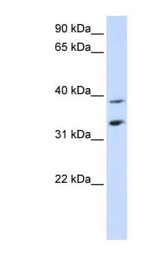 SLC25A34 Antibody (C-Terminus)