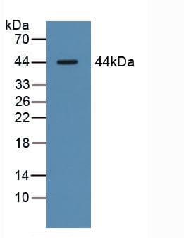ASGR1 / ASGPR Antibody (aa77-289)