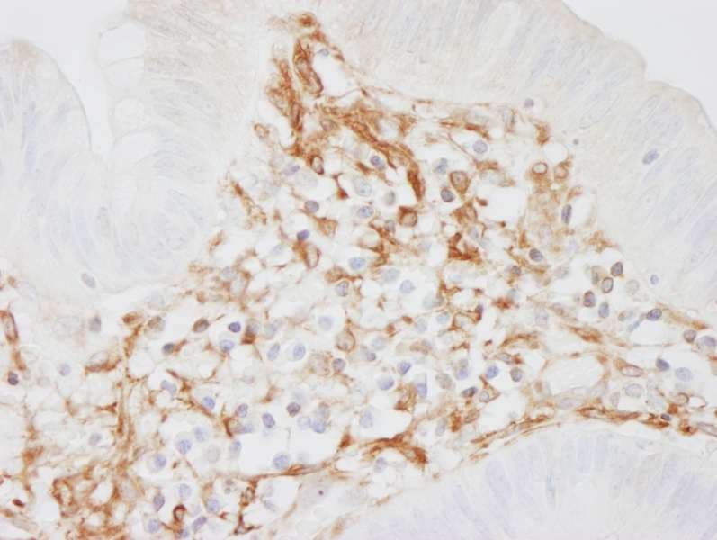Polyclonal Rabbit anti-Human FLNA / Filamin A Antibody (aa2597-2647, IHC, WB)