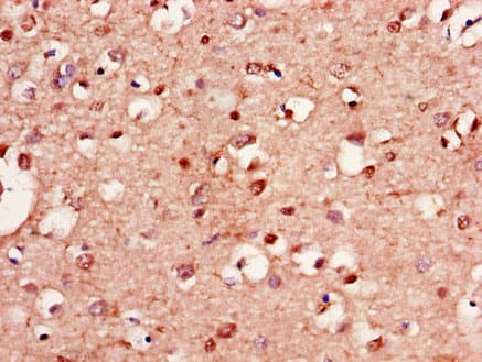 LANCL1 Antibody
