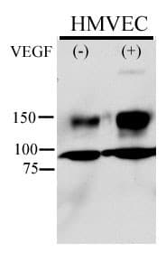 Polyclonal Rabbit anti-Human KDR / VEGFR2 / FLK1 Antibody (phospho-Tyr996, IHC, WB)