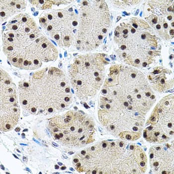 DAP-5 / EIF4G2 Antibody