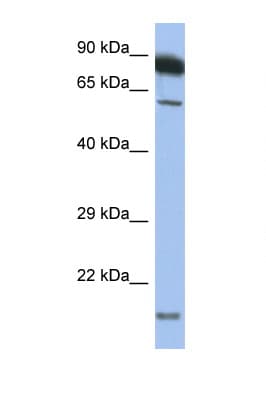 TNFRSF10A / DR4 Antibody (aa397-446)