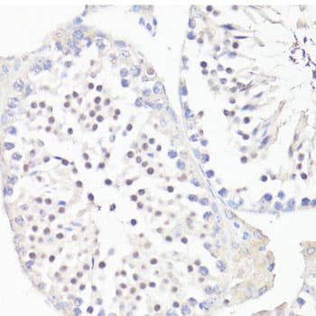 GLI / GLI1 Antibody