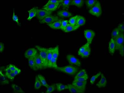 Polyclonal Rabbit anti-Human KIR2DS5 Antibody (IF)
