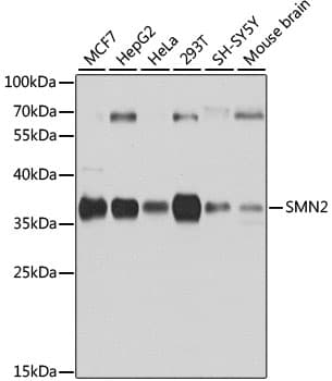 Polyclonal Rabbit anti-Human SMN2 Antibody (IHC, IF, WB)