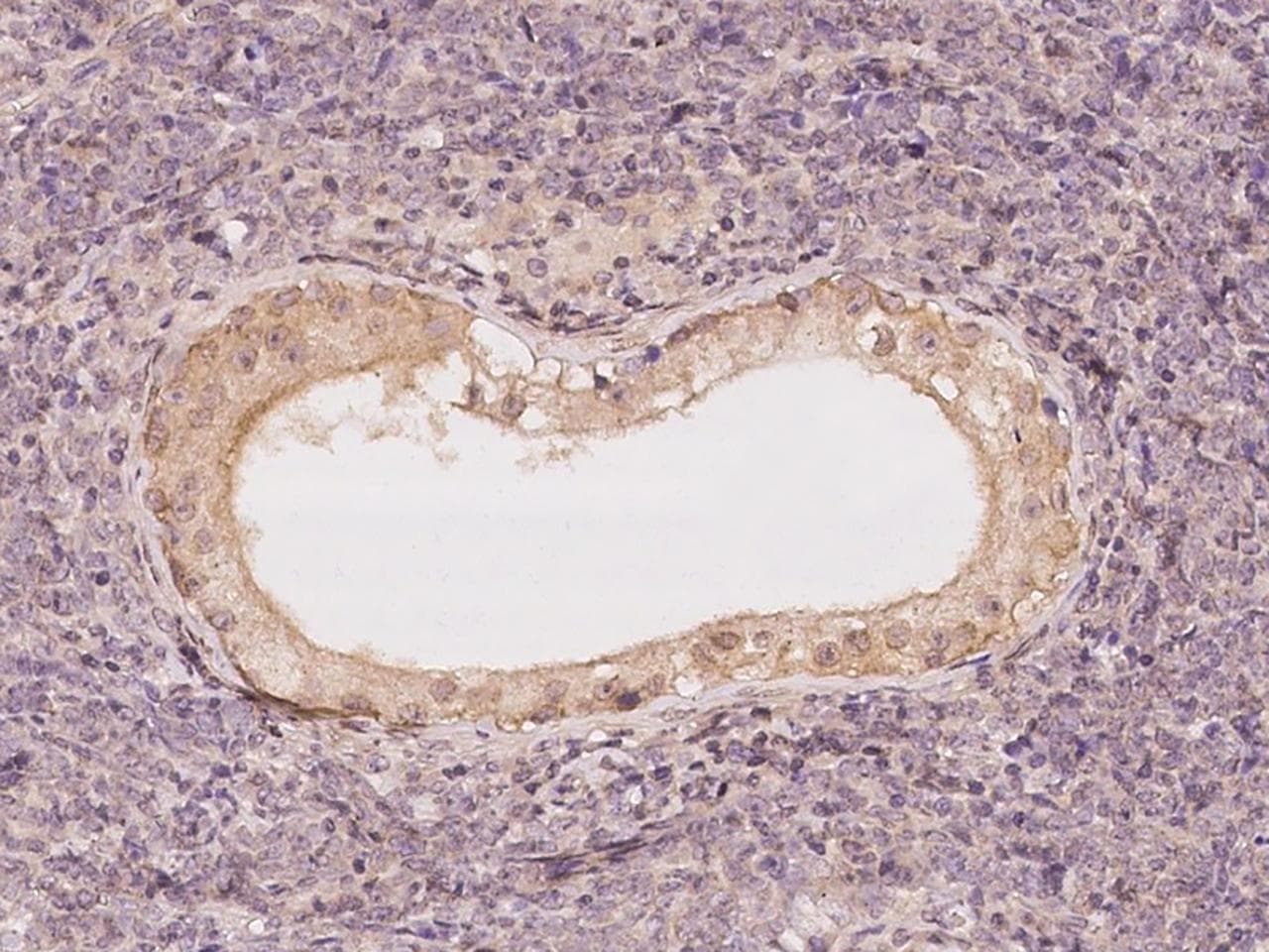TSC22D2 Antibody
