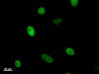 Monoclonal Mouse anti-Human KIF22 / OBP Antibody (clone 2486C3a, IF, WB)