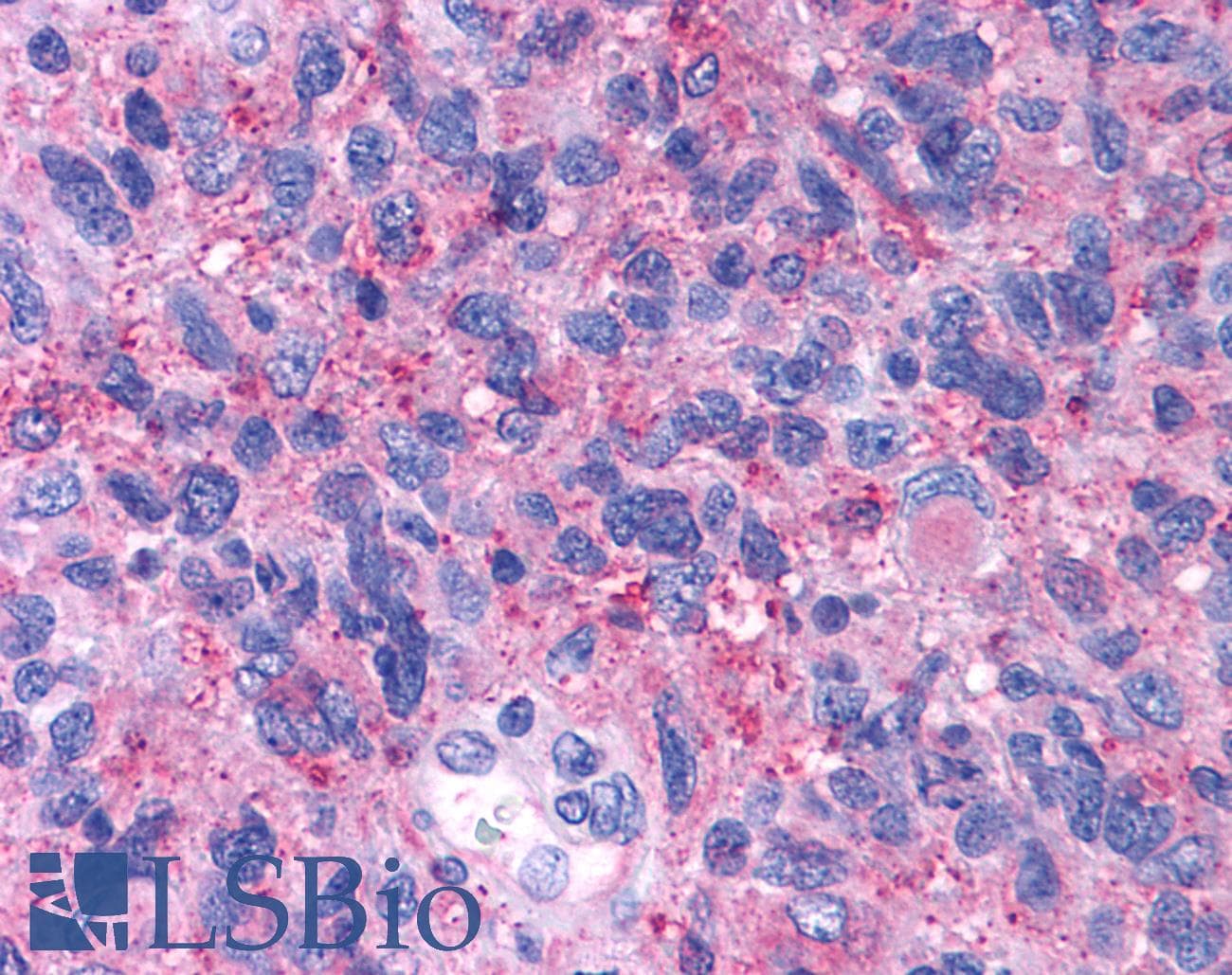 PathPlus™ CRFR1 / CRHR1 Antibody (N-Terminus)