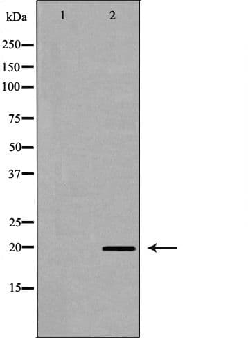 TPT1 / TCTP Antibody