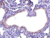 SLPI / Antileukoproteinase Antibody
