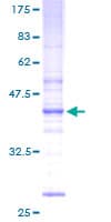 Human UBE2W Protein (Recombinant GST)