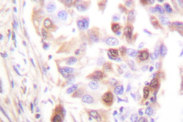 RPA2 / RFA2 / RPA34 Antibody (Ala17)