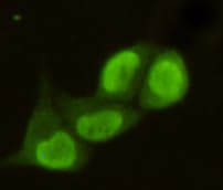 Monoclonal Mouse anti-Human PRMT6 Antibody (IHC, WB)