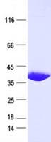 Human PTP1B Protein (Recombinant His, N-Terminal)