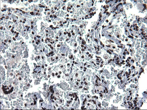 Monoclonal Mouse anti-Human ARNTL / BMAL1 Antibody (clone OTI1H6, IHC, WB)
