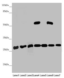 PGLS / 6PGL Antibody