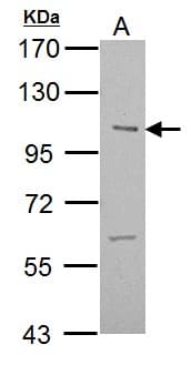ULK2 Antibody (aa693-968)