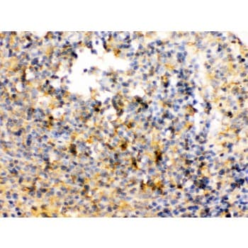 TRIB2 Antibody (aa175-211)