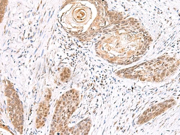 EWSR1 / EWS Antibody