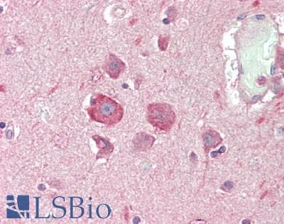 IHC-plus™ SMG6 Antibody