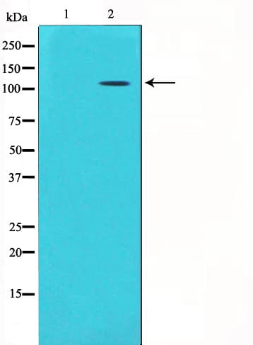 GRIK1 / GLUR5 Antibody