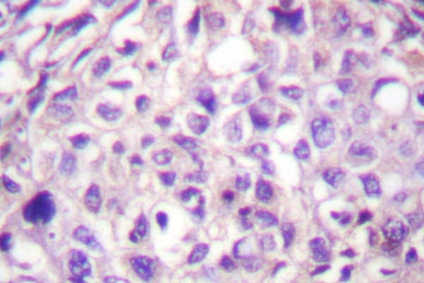 MAP3K8 / TPL2 Antibody (Pro284)