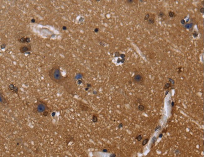 FGFR1OP / FOP Antibody