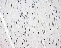 SRR / Serine Racemase Antibody (clone OTI2E3)