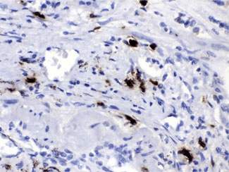 Polyclonal Rabbit anti-Human CPB2 / TAFI Antibody (IHC, WB)