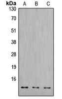 PathPlus™ CTSD / Cathepsin D Antibody (Internal)