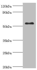 IHC-plus™ GCK / Glucokinase Antibody (aa1-300)
