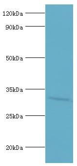 Polyclonal Rabbit anti-Human AGPAT1 Antibody (aa204-283, IHC, WB)