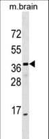 ELMOD1 Antibody (aa106-135)