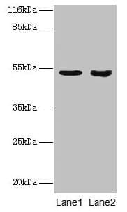 Polyclonal Rabbit anti-Human SKP2 Antibody (aa1-424, IHC, WB)