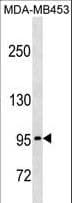 PCDHGA5 Antibody (aa254-280)