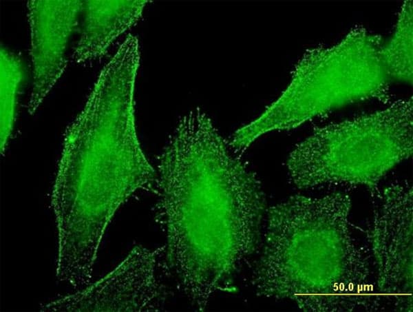 Monoclonal Mouse anti-Human Dystonin / BPAG1 Antibody (clone 1B10, IF, WB)