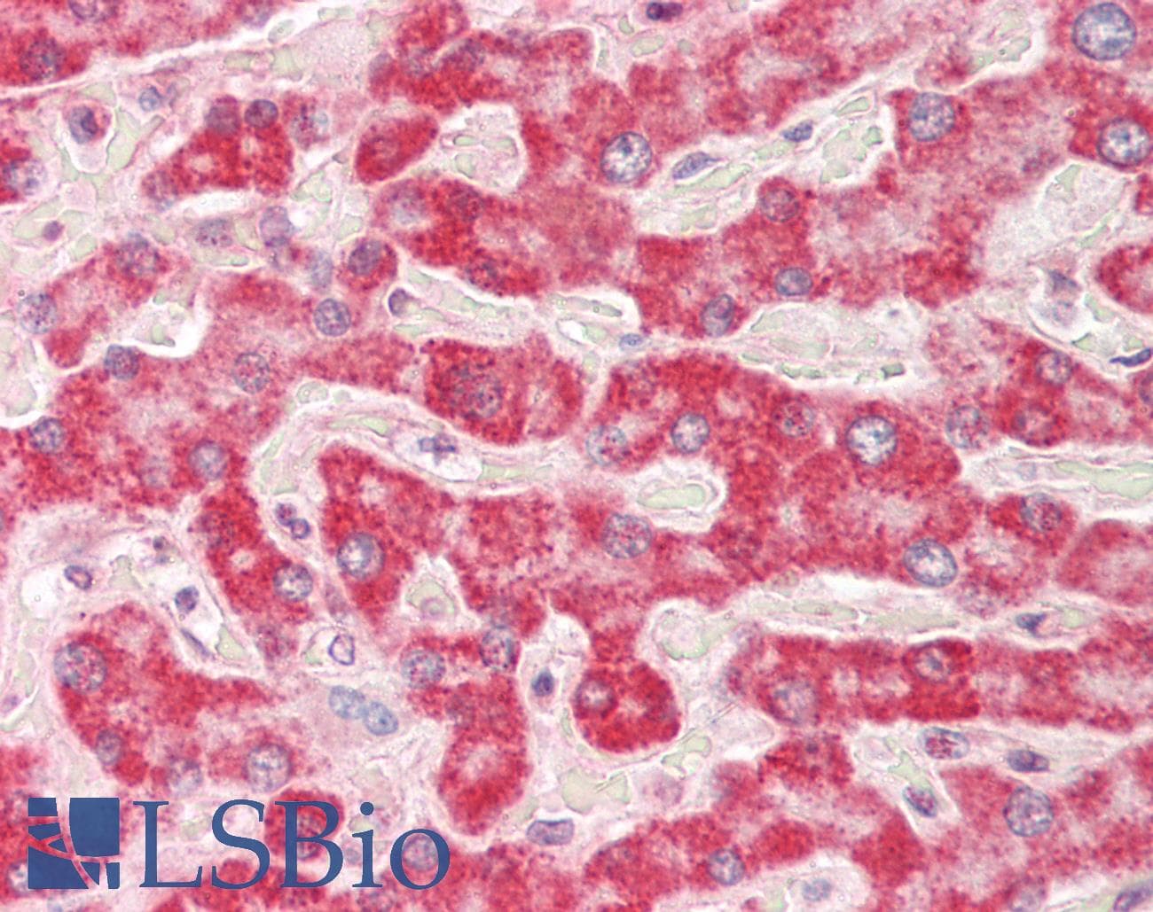 Polyclonal Rabbit anti-Human HADH Antibody (aa149-198, IHC, WB)