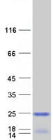 Human ICT1 / DS1 Protein (Recombinant Myc-DDK (Flag))