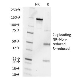 Progesterone Antibody (clone 6-5E-10B)
