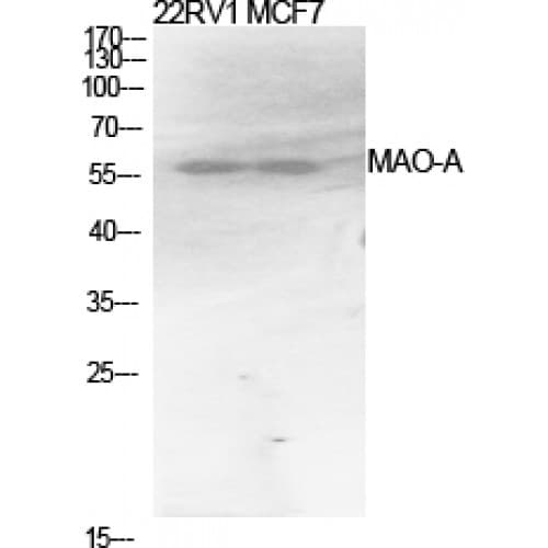 MAOA / Monoamine Oxidase Antibody (Internal)