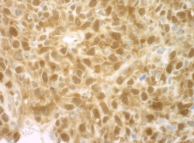 EIF4EBP1 / 4EBP1 Antibody (aa75-C-term)