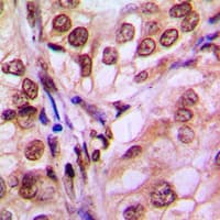 EIF4EBP1 / 4EBP1 Antibody (Internal)