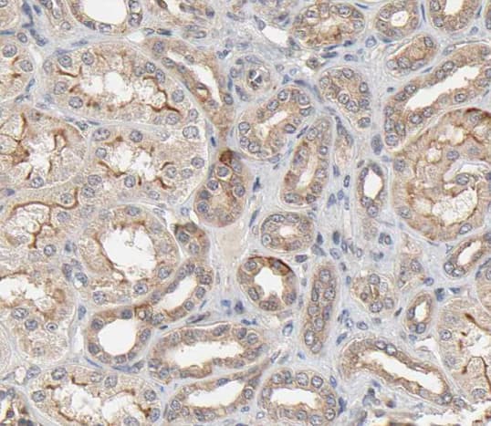 Polyclonal Rabbit anti-Human PDGFRA / PDGFR Alpha Antibody (IHC, IF, WB)