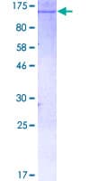 Human HK1 / Hexokinase 1 Protein (Recombinant GST)